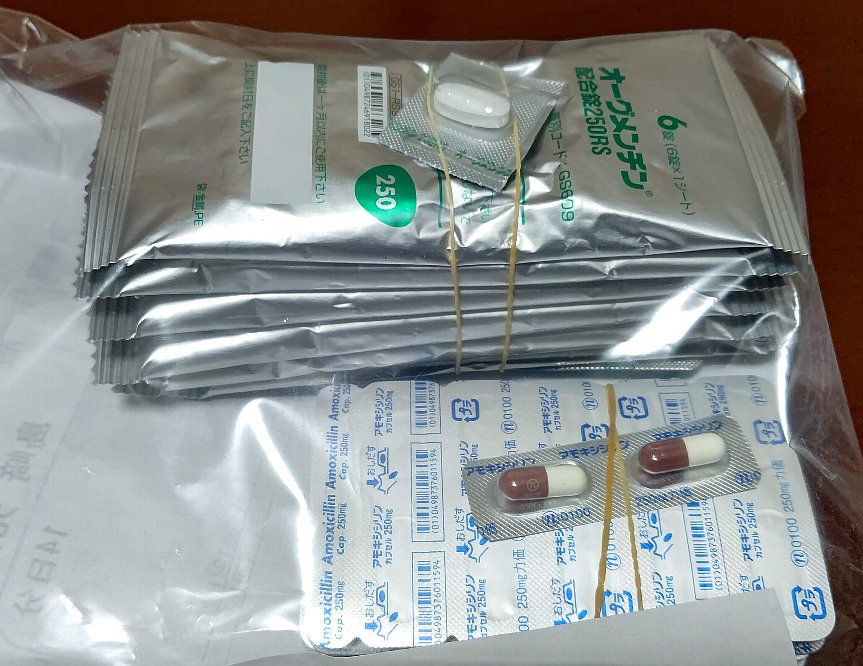 肺炎になりましたが、自宅で抗生物質を飲んで治療です-2021-10-16